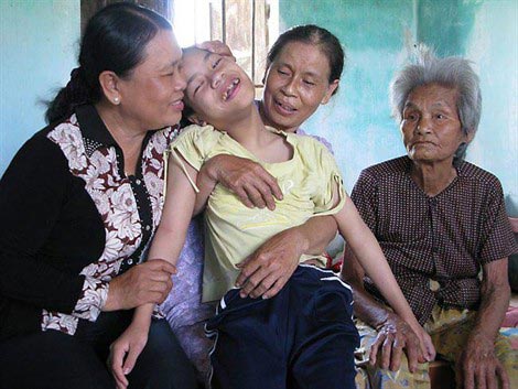 Le Vietnam n'en a pas fini avec l'agent orange Le Vietnam n'en a pas fini avec l'agent orange