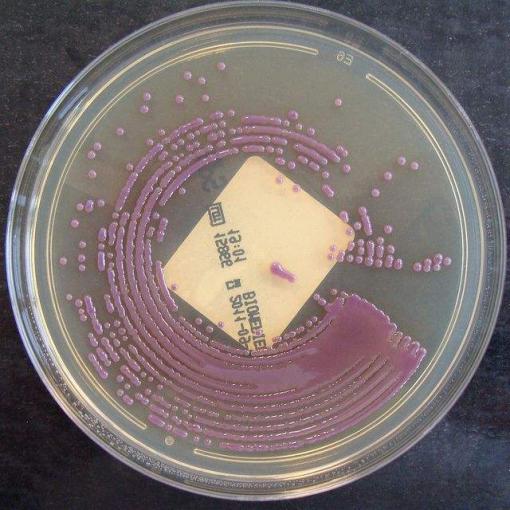 Un patient revenant du Vietnam infecté par la superbactérie NDM-1 en France Un patient revenant du Vietnam infecté par la superbactérie NDM-1 en France