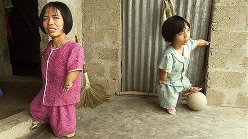 L’Agent Orange et la guerre du Vietnam.